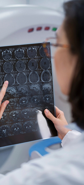 Una profesional de la salud, vista desde atrás y con gafas, examina detalladamente una placa de imágenes médicas que muestra múltiples cortes transversales de un cerebro (resonancia magnética o tomografía). Con su dedo índice señala un área específica en uno de los estudios. Al fondo, se aprecia de forma desenfocada lo que parece ser un equipo de diagnóstico por imagen, sugiriendo un entorno clínico especializado en neurología o radiología.